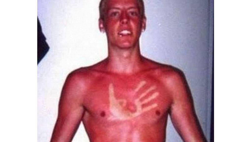 El bronceado, entre la belleza y el horror