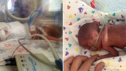 Bebe Prematuro De 5 Meses Puede Sobrevivir Consejos De Bebe Bebe Prematuro De 5 Meses Puede Sobrevivir Consejos De Bebe
