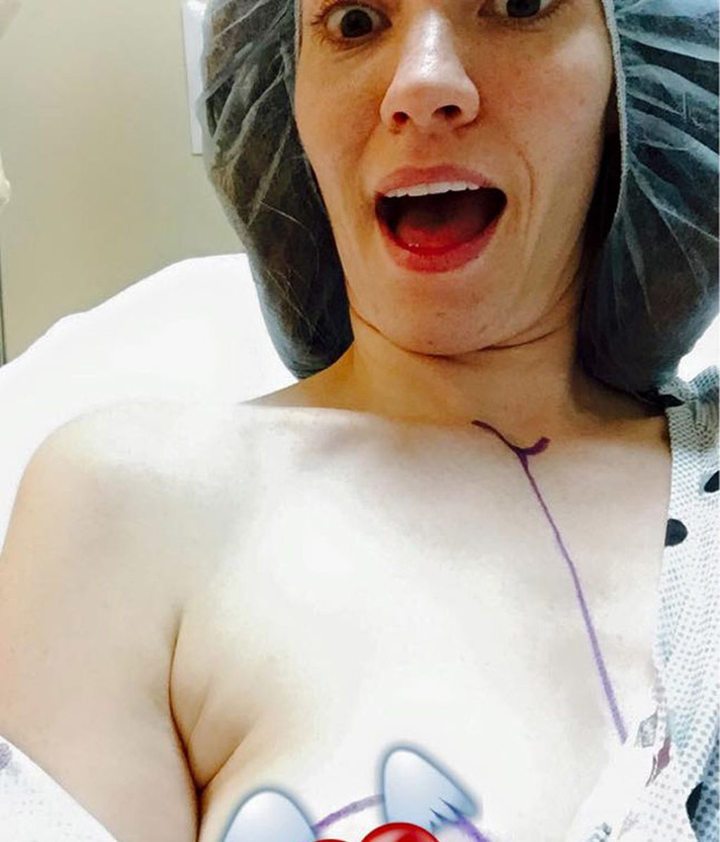 Cómo esta modelo superó el cáncer usando el humor