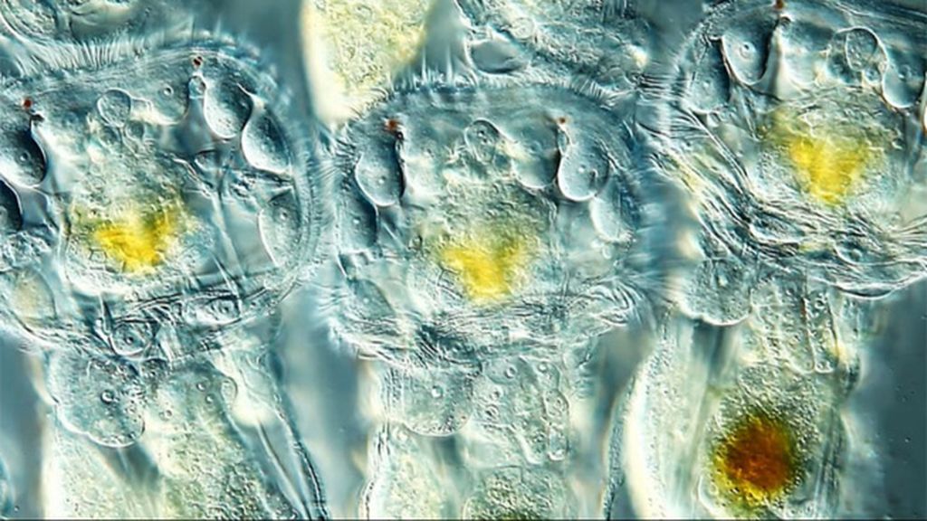 Las imágenes de microscopio ganadoras Las imágenes de microscopio ganadoras