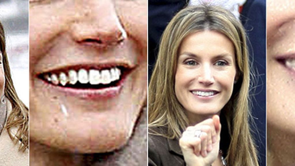 dientes