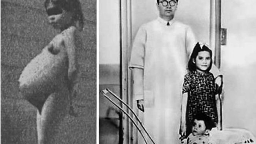 Los nacimientos más raros del mundo