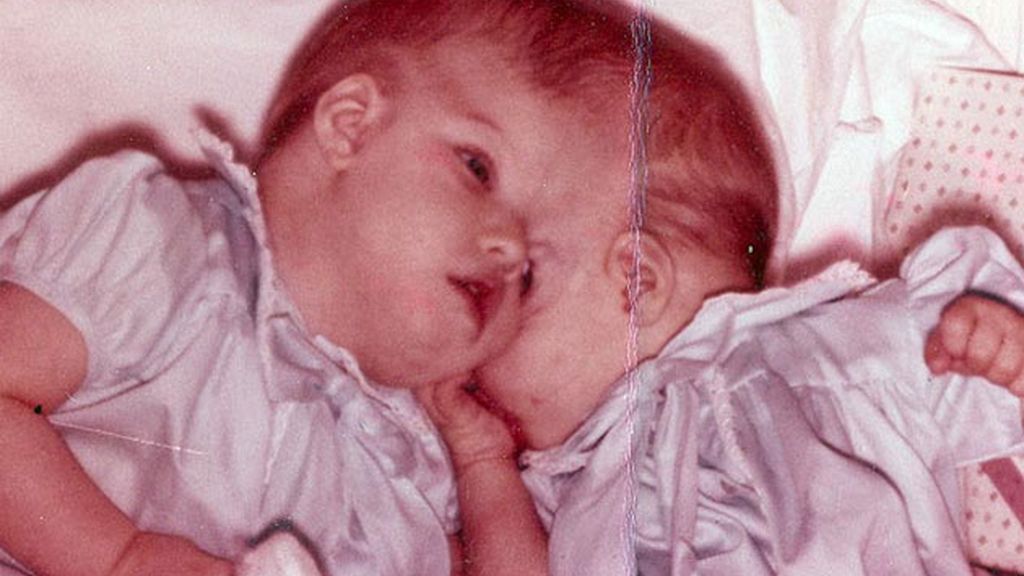 Unidos por la cabeza desde hace medio siglo