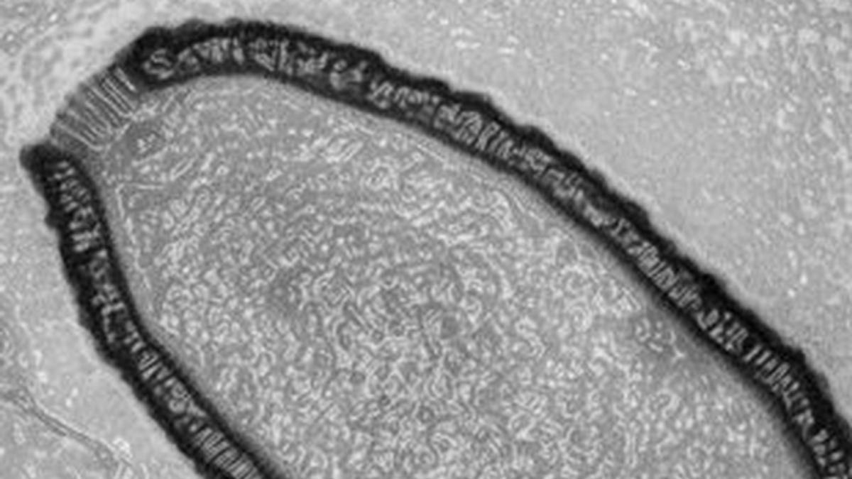 Un gigantesco virus de 30.000 años que todavía puede infectar