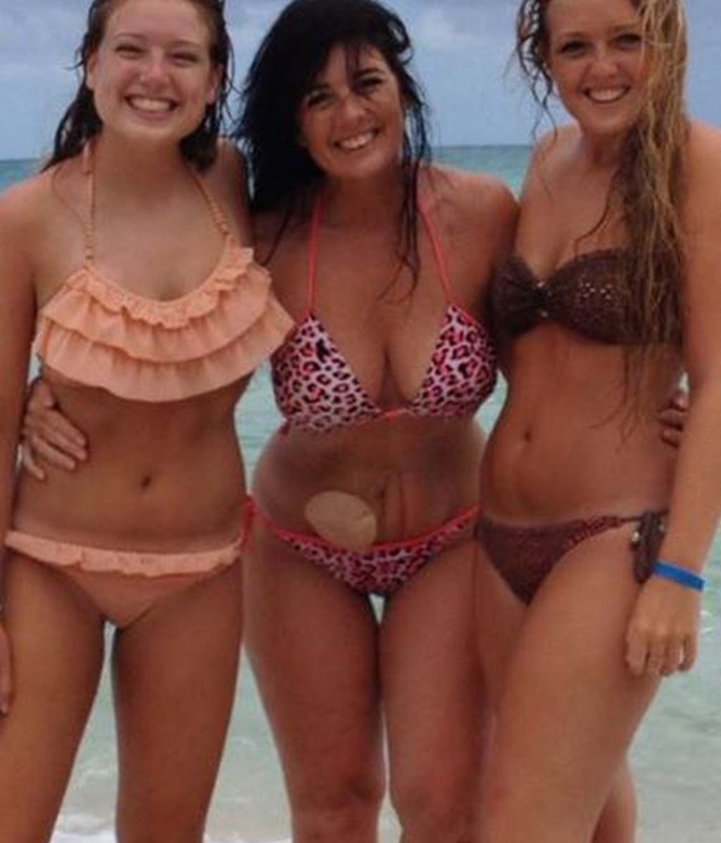 Cientos de enfermos de Crohn dejan de esconder sus fotos de resíduos gracias a la iniciativa de una modelo