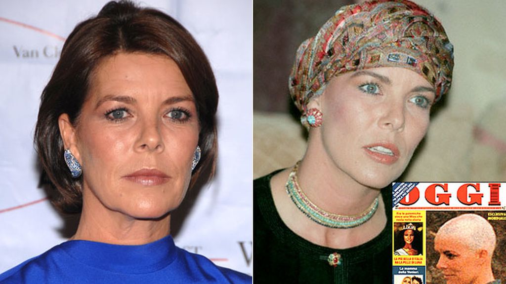 Andrea Casiraghi pierde la melena