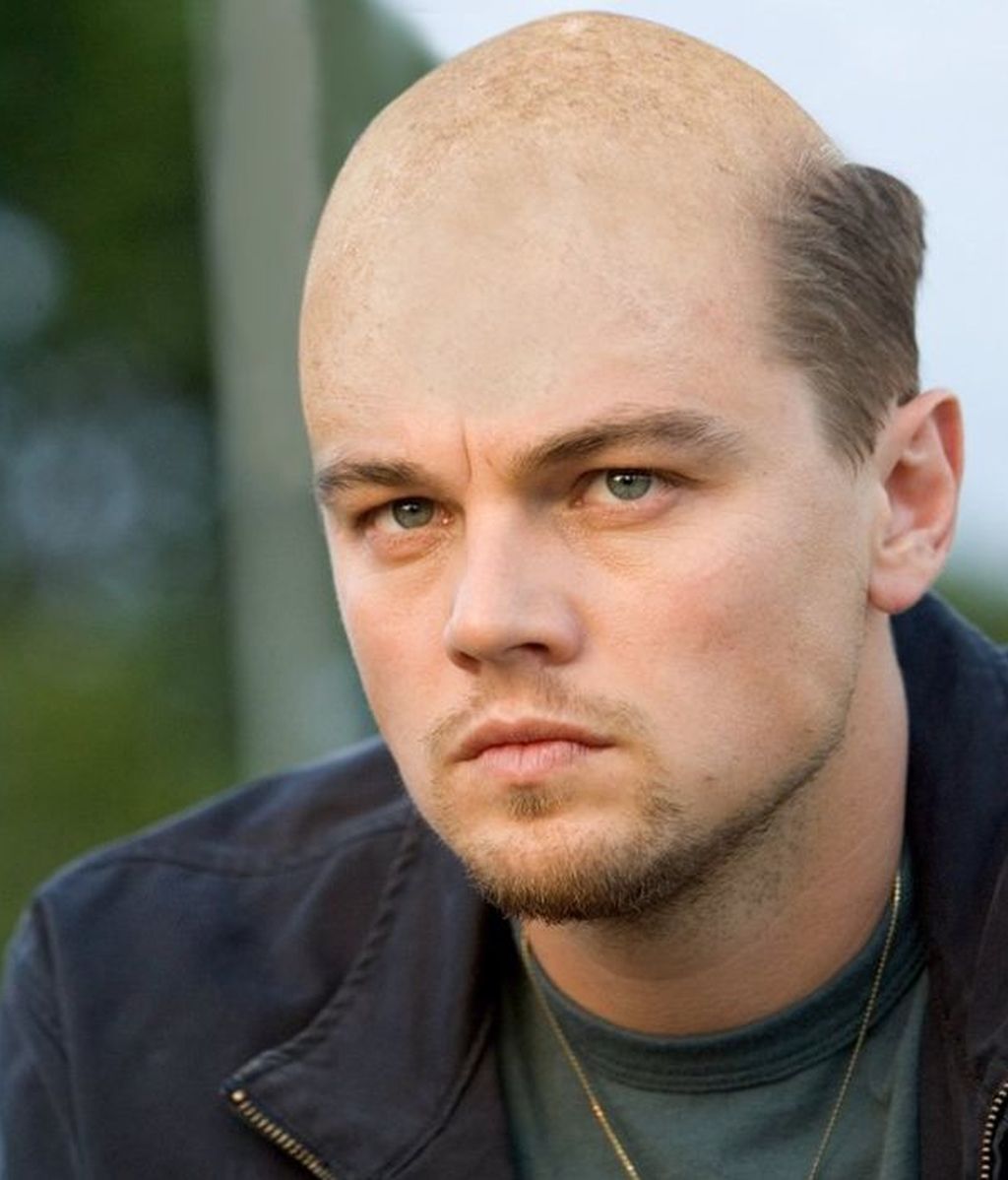 Si estos famosos fueran calvos