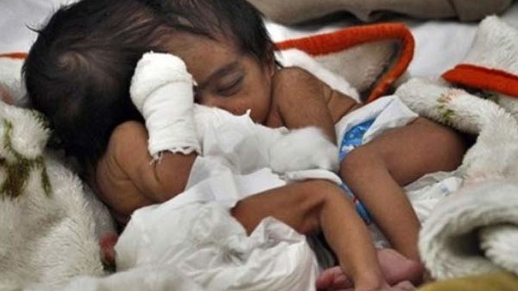 Unidas por la cabeza