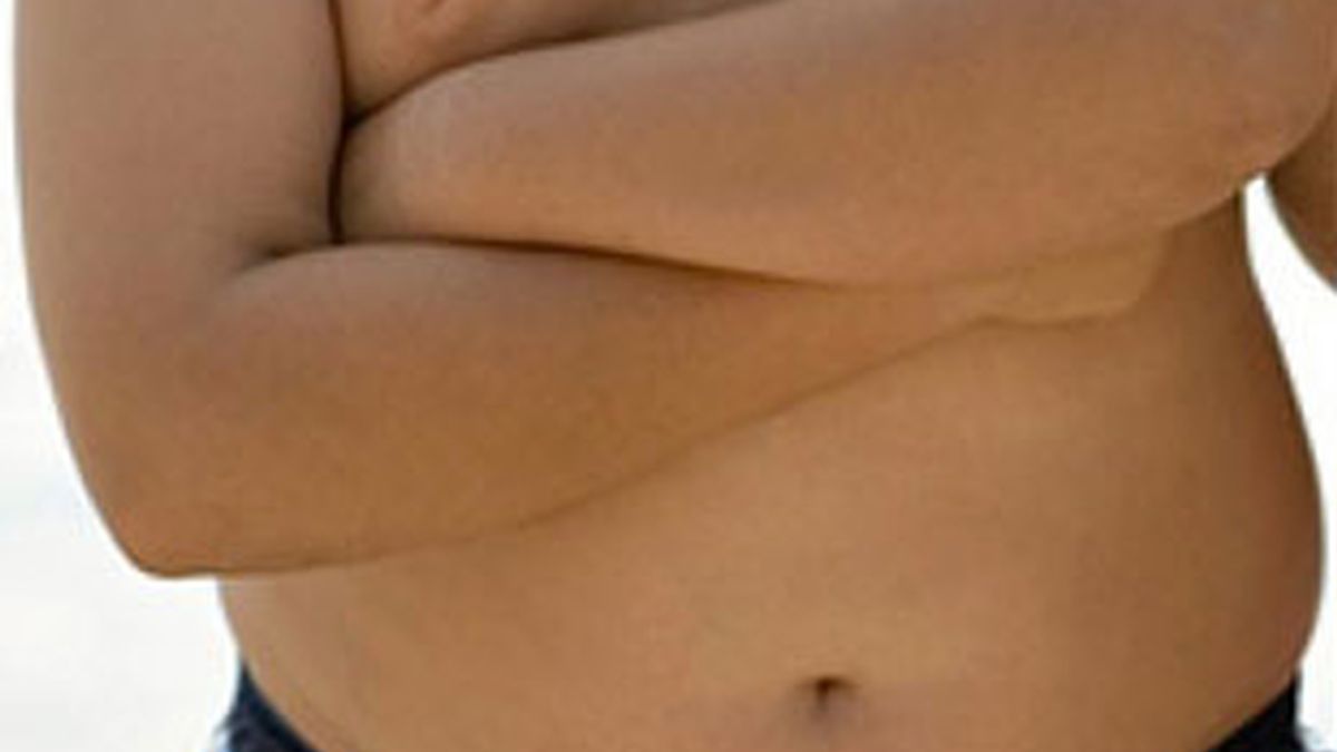 Los niños con sobrepeso pueden sufrir enfermedades cardiacas de adolescentes. Foto: EFE
