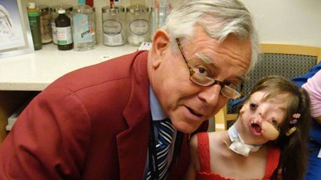 Sin cara por una malformación genética