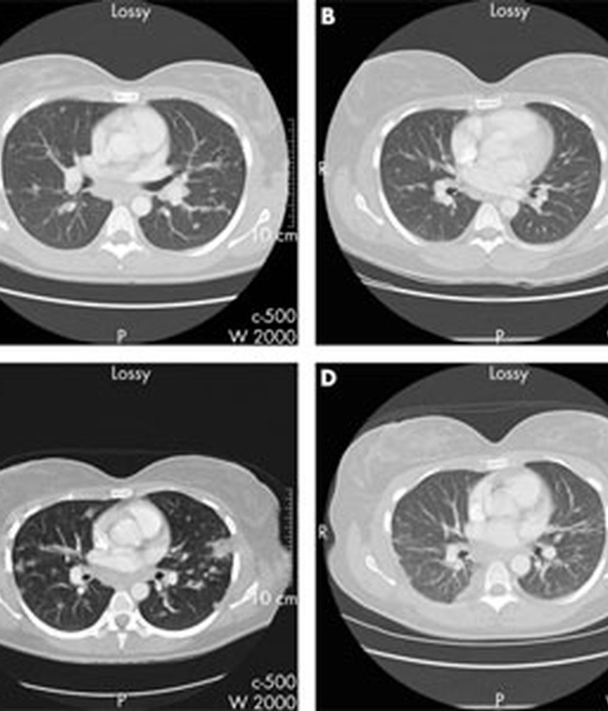 La revista publica un especial sobre la relación entre la artritis y el alcohol. FOTO: Annals of Rheumatic Diseases