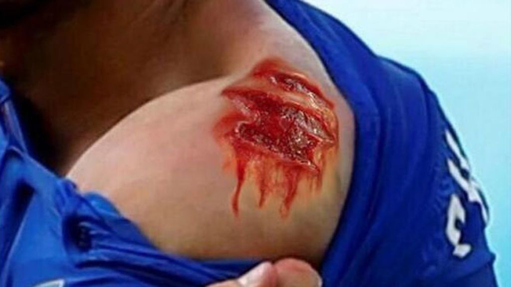 Los memes del mordisco de Luis Suárez a Chiellini