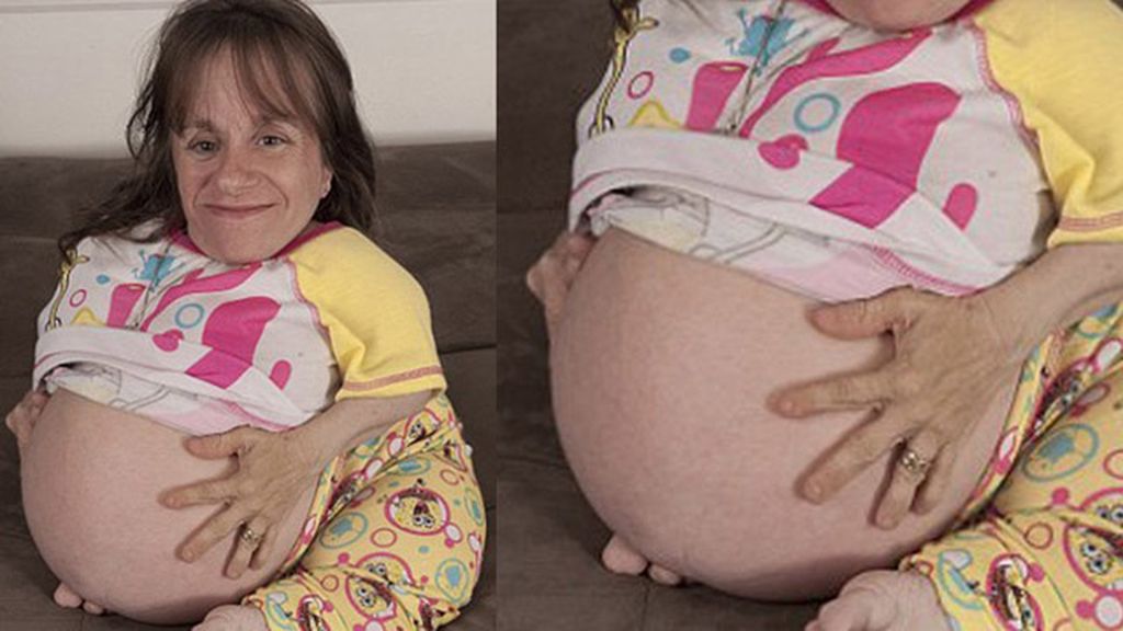 Los nacimientos más raros del mundo