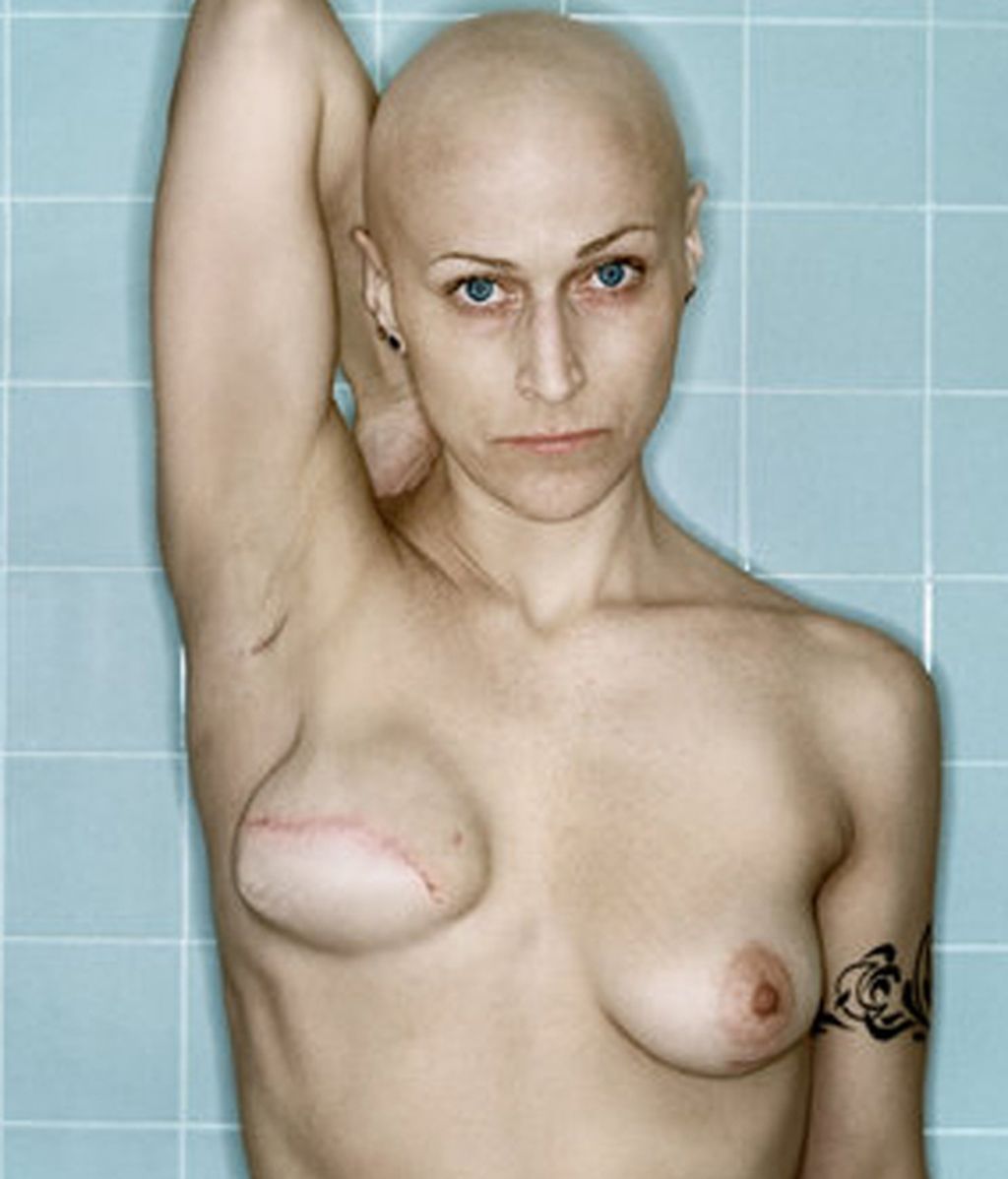 La fotógrafa Kerry Mansfield documenta su cáncer