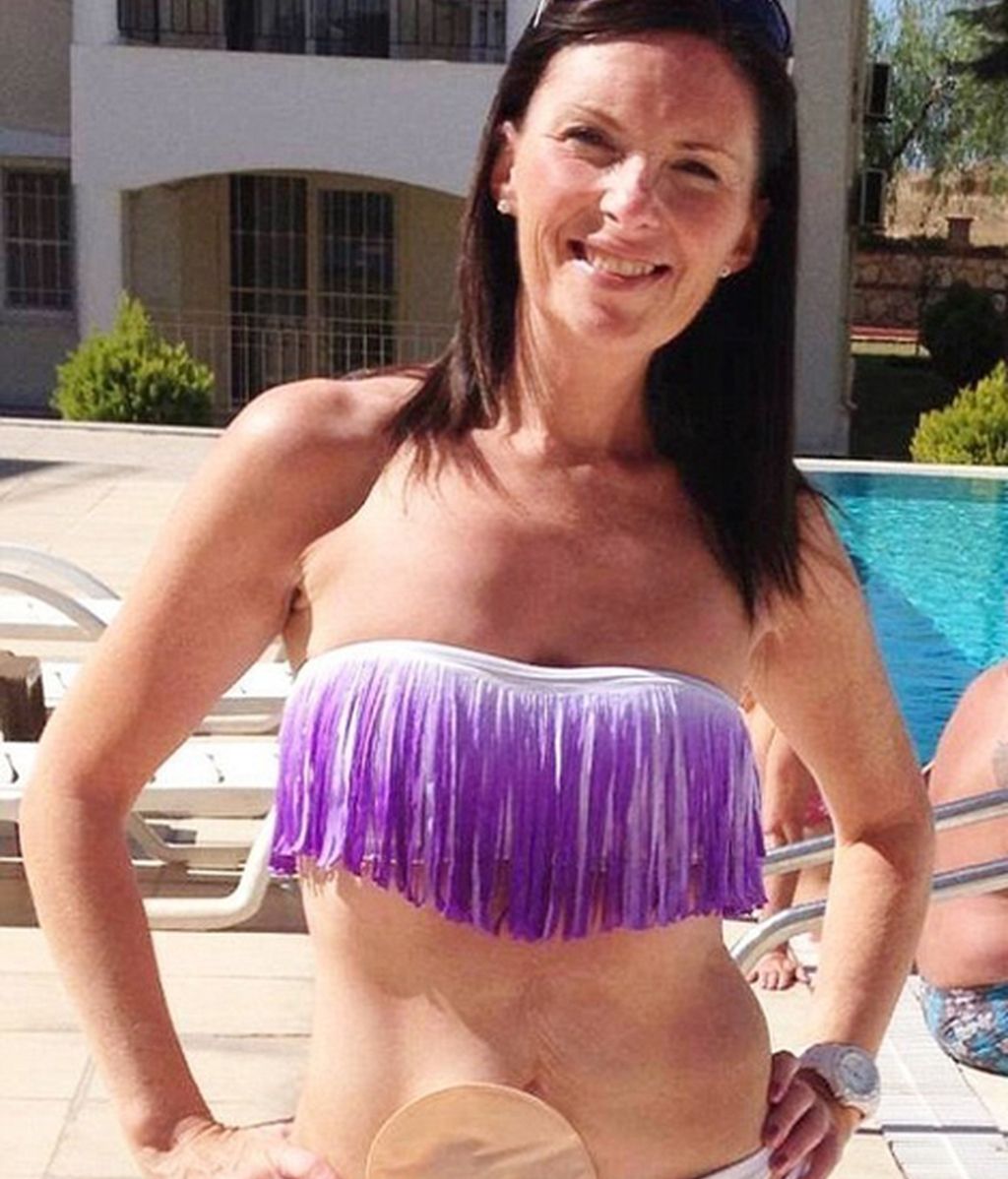 Cientos de enfermos de Crohn dejan de esconder sus fotos de resíduos gracias a la iniciativa de una modelo