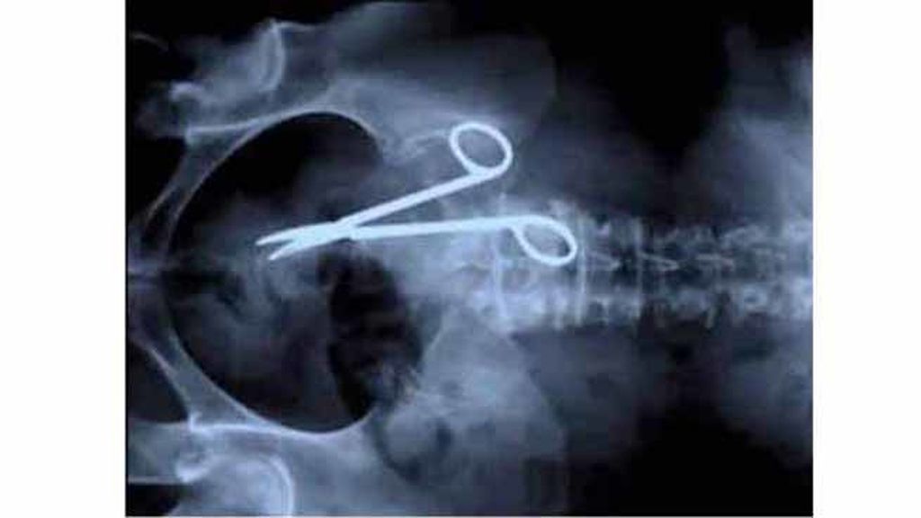 Objetos inesperados dentro del cuerpo
