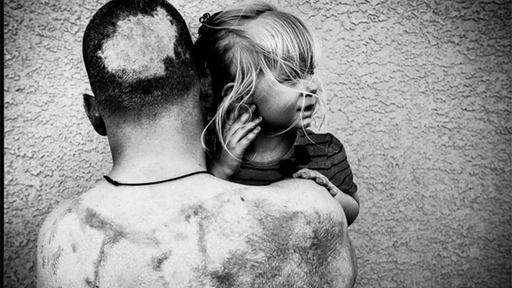 Las heridas de los soldados desconocidos