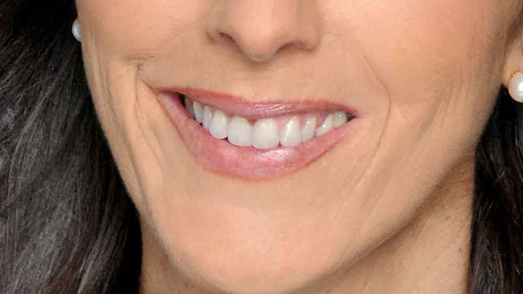 ¿De qué famosos son estas sonrisas?