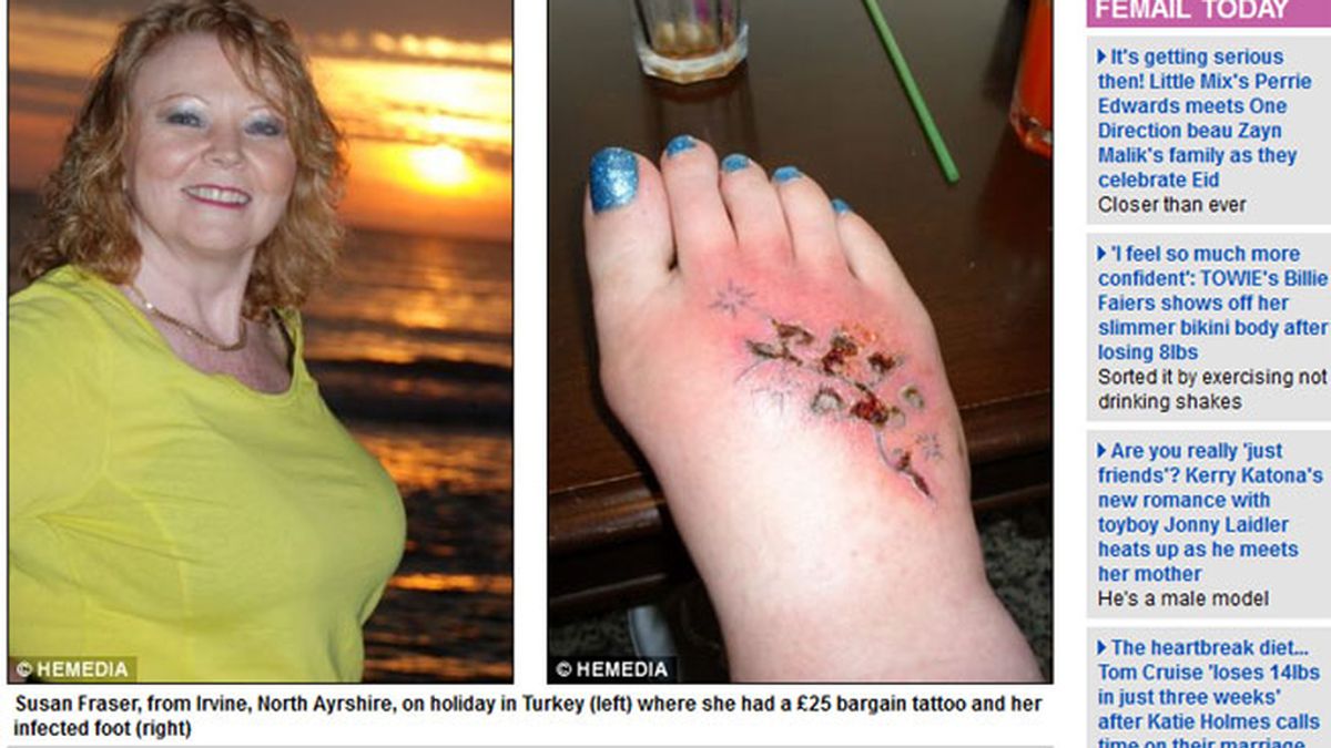 Puede perder el pie por haberse hecho un tatuaje durante las vacaciones
