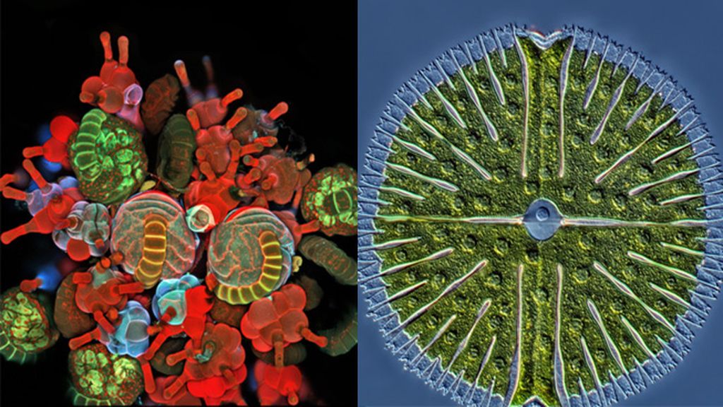 Las imágenes de microscopio ganadoras