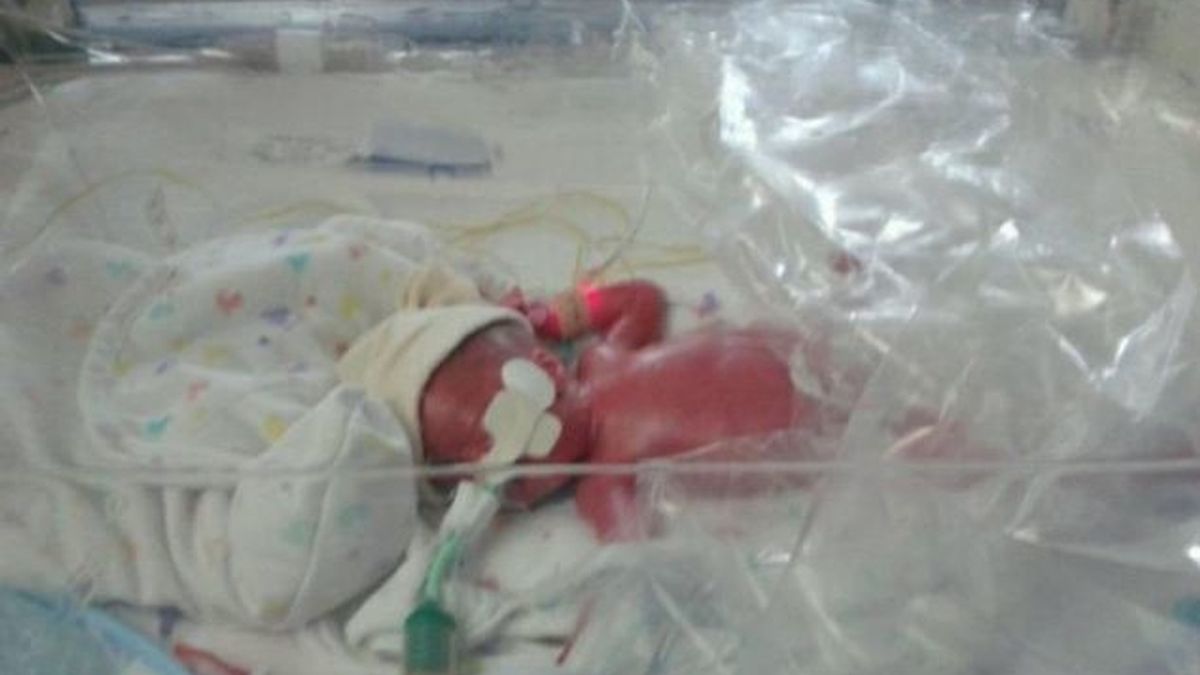 Bebé prematuro protegido en una bolsa de plástico convencional
