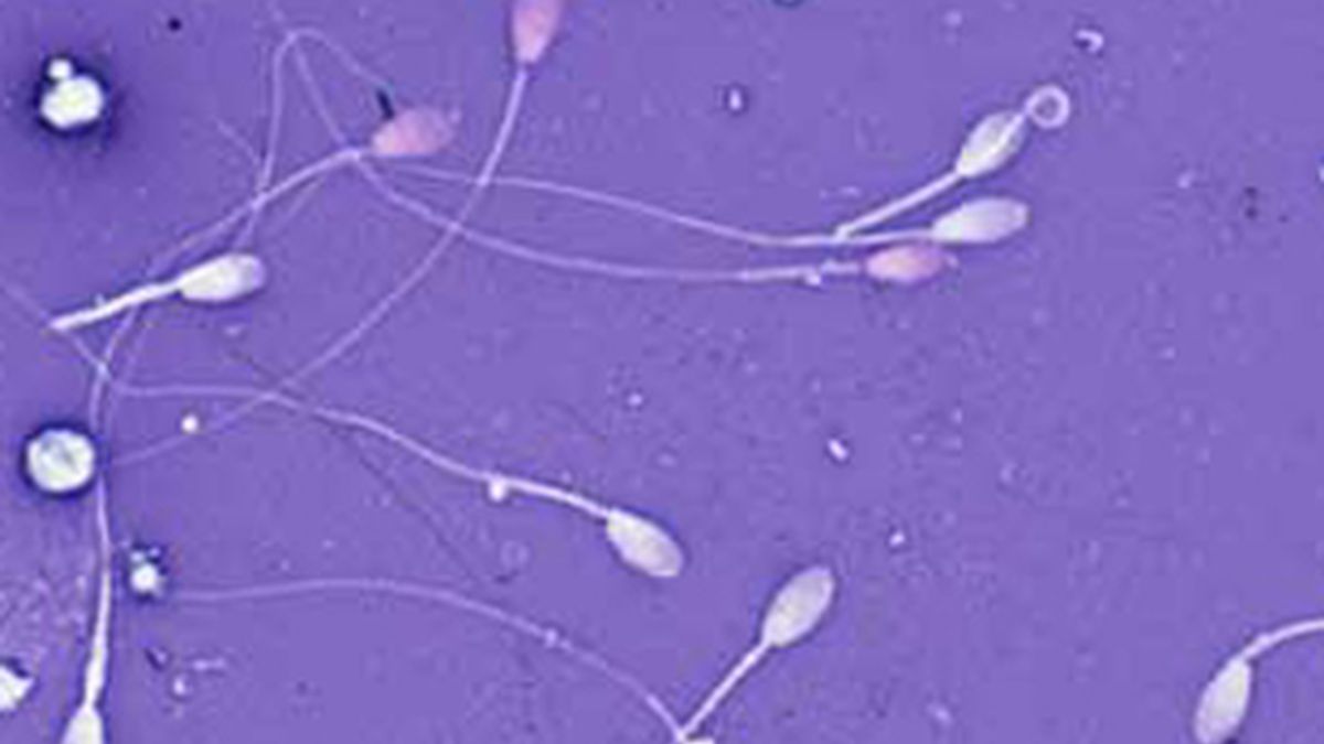 ¿Elegir al mejor espermatozoide? Foto: Archivo.
