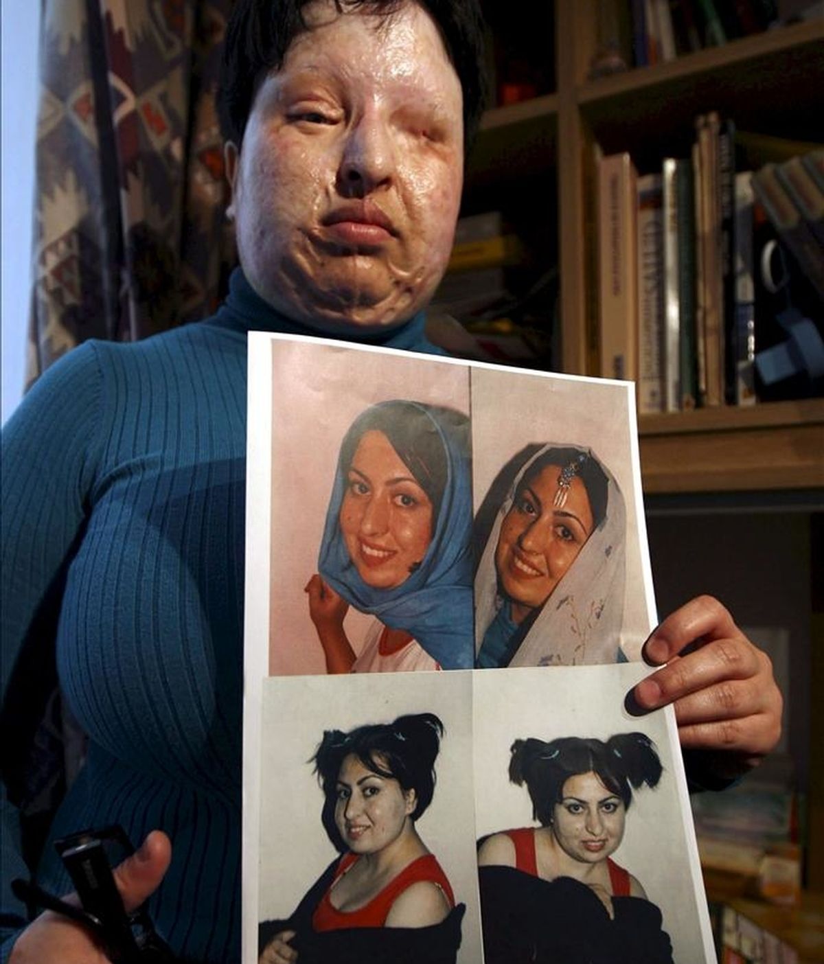 Fotografía de archivo tomada el 4 de marzo de 2009 que muestra a la iraní Ameneh Bahrami mostrando fotografías suyas antes de quedarse ciega en 2004 después de que un compañero de facultad, Majid Movahedi, le quemara el rostro por negarse a casarse con él. Amnistía Internacional pidió ayer a Irán desde Londres que se le condone la sentencia que debía llevarse a cabo hoy, sábado, 14 de mayo de 2011. EFE