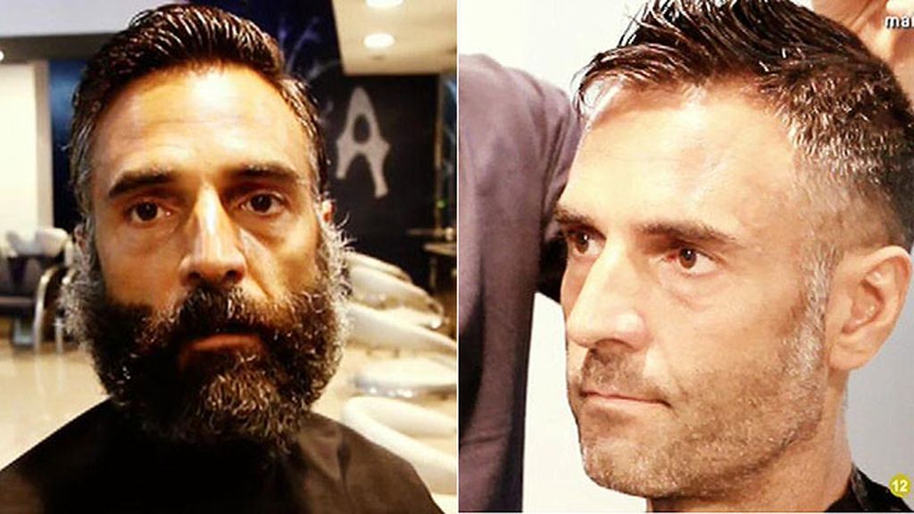 El antes y el después del superviviente