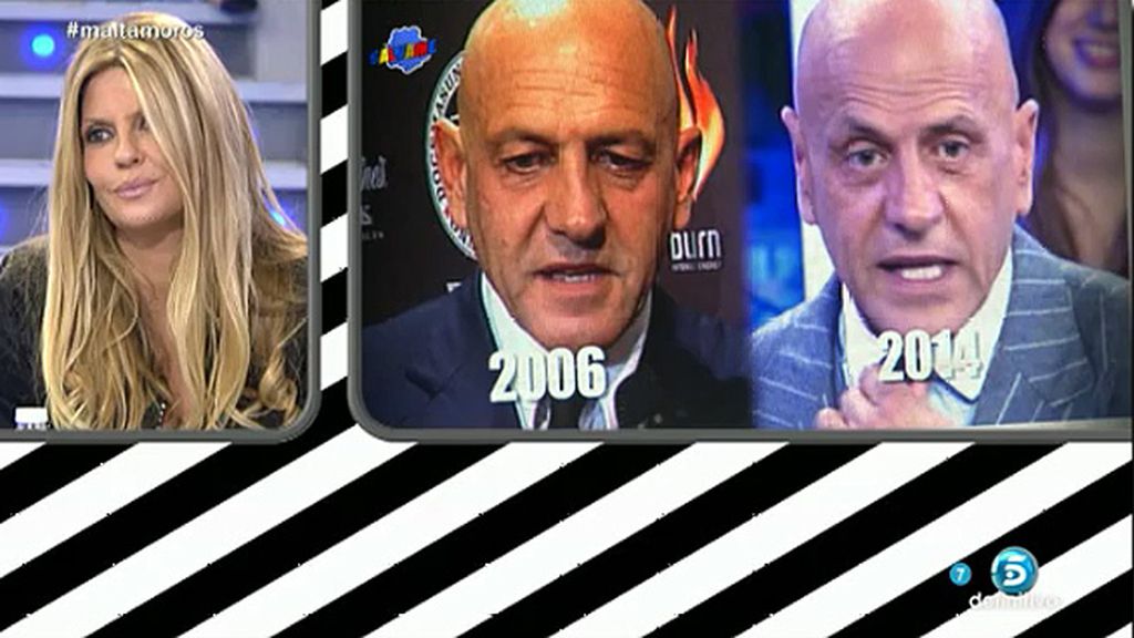 El colaborador se ha operado la nariz por un problema respiratorio