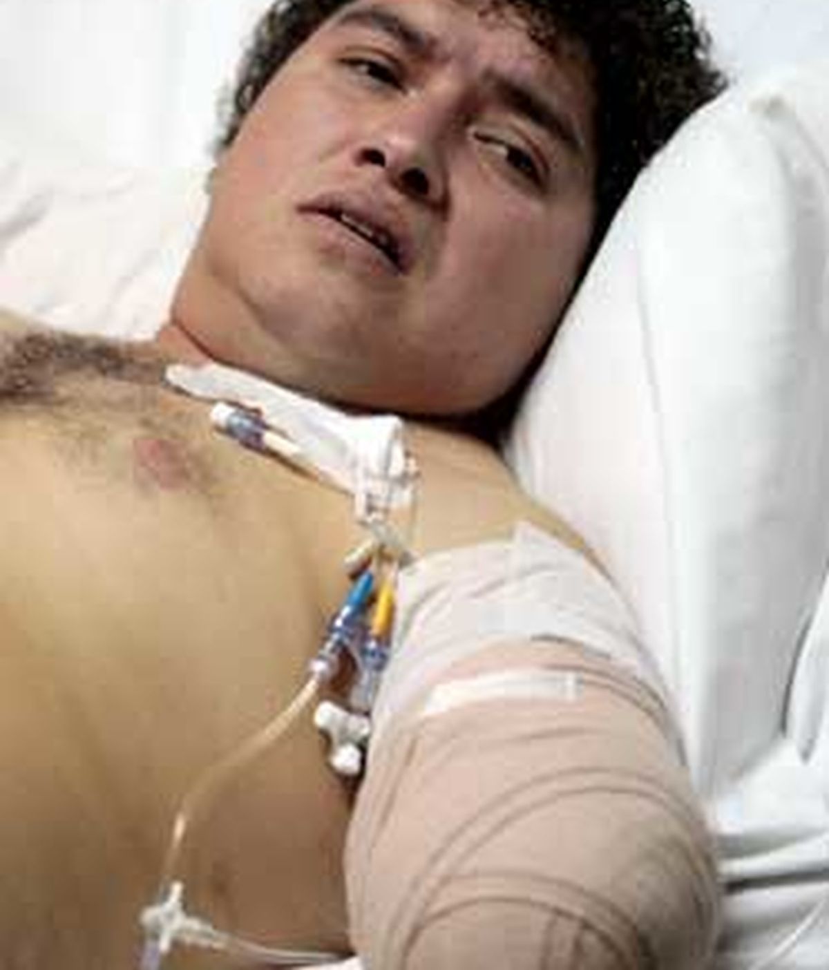 El empleado boliviano se recupera en el hospital. Foto: EFE.
