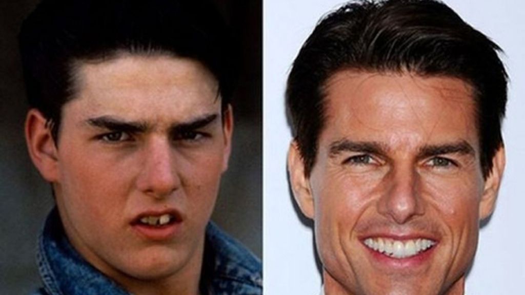 dientes