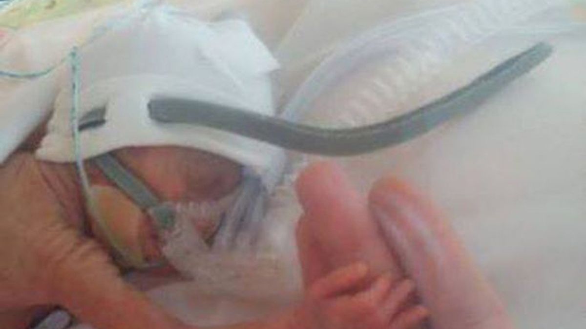 Claire Cressey acaricia a Emiliy su bebé prematura