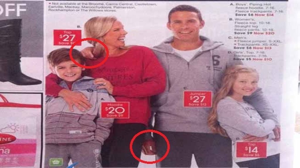 El hombre con tres brazos
