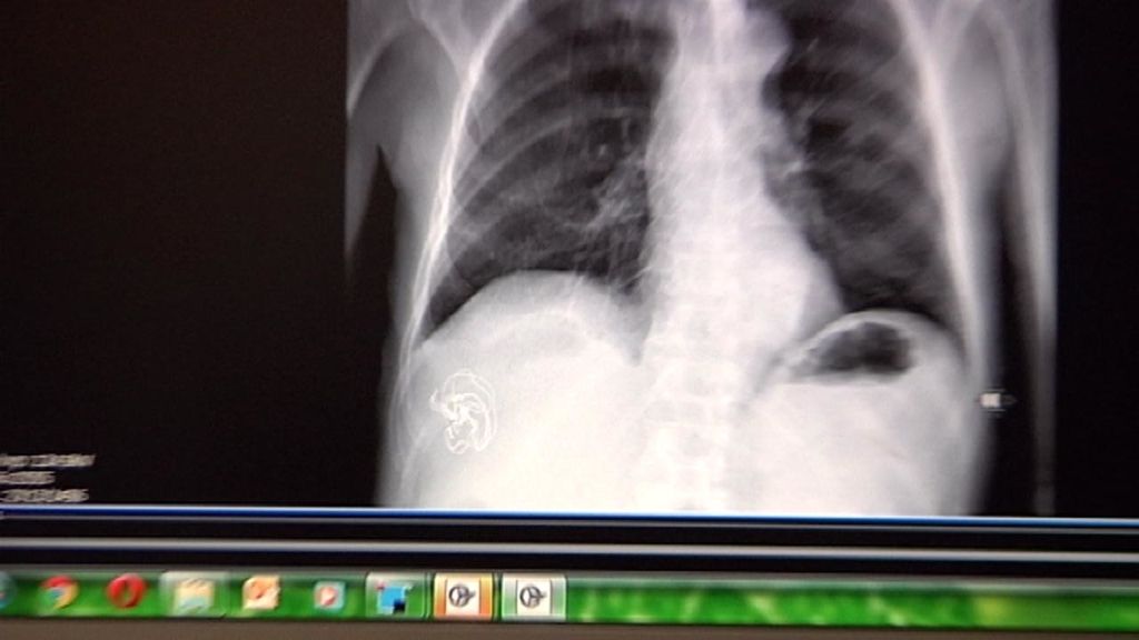 Callejeros examina a la Sanidad Pública