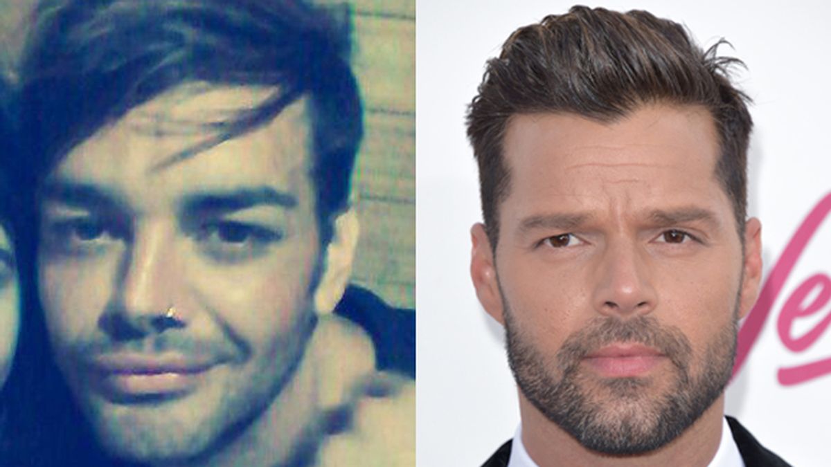 Un argentino adicto a las operaciones para parecerse a Ricky Martin