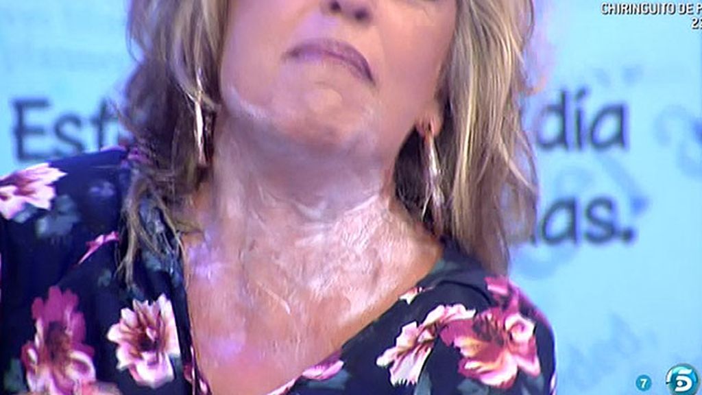 Lydia Lozano acaba llena de crema