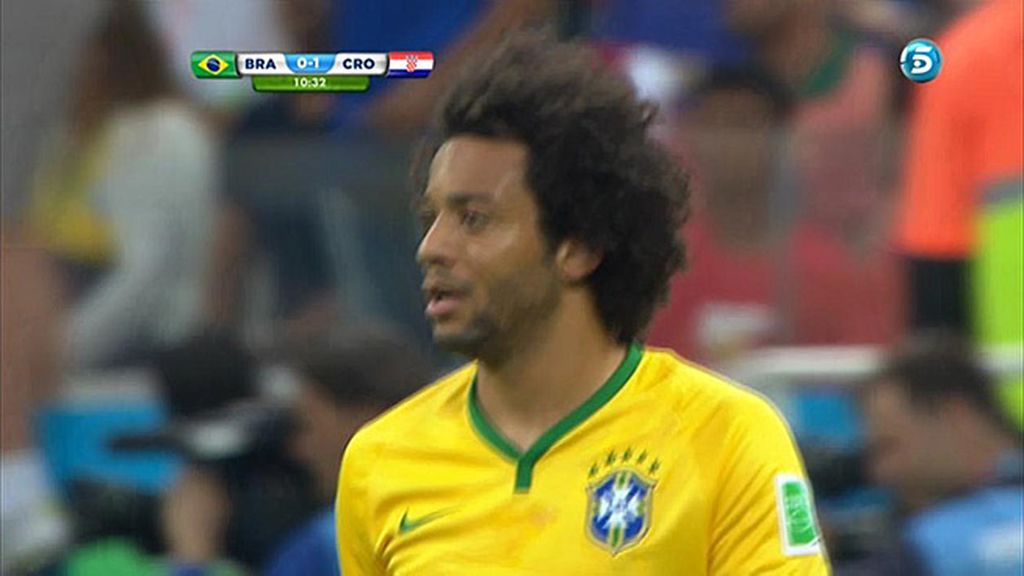 Así le quedo la cara al defensa después del autogol