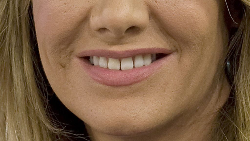¿De qué famosos son estas sonrisas?