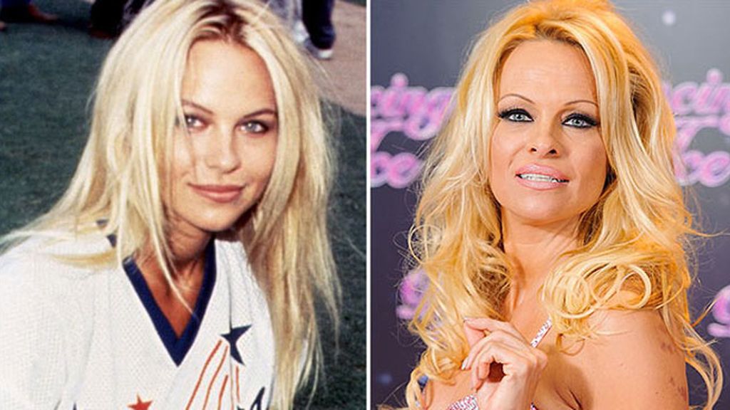 Pamela Anderson