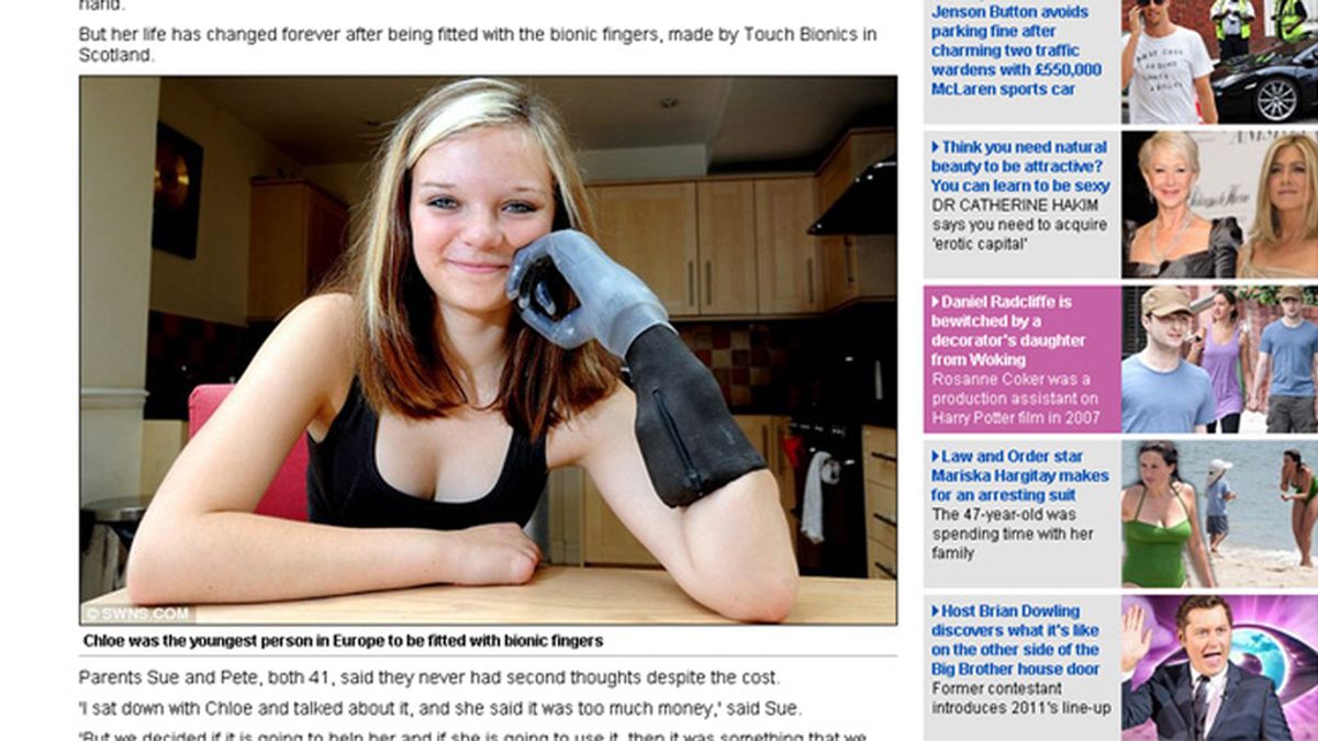 La joven con sus nuevos dedos biónicos. Foto: Daily Mail.
