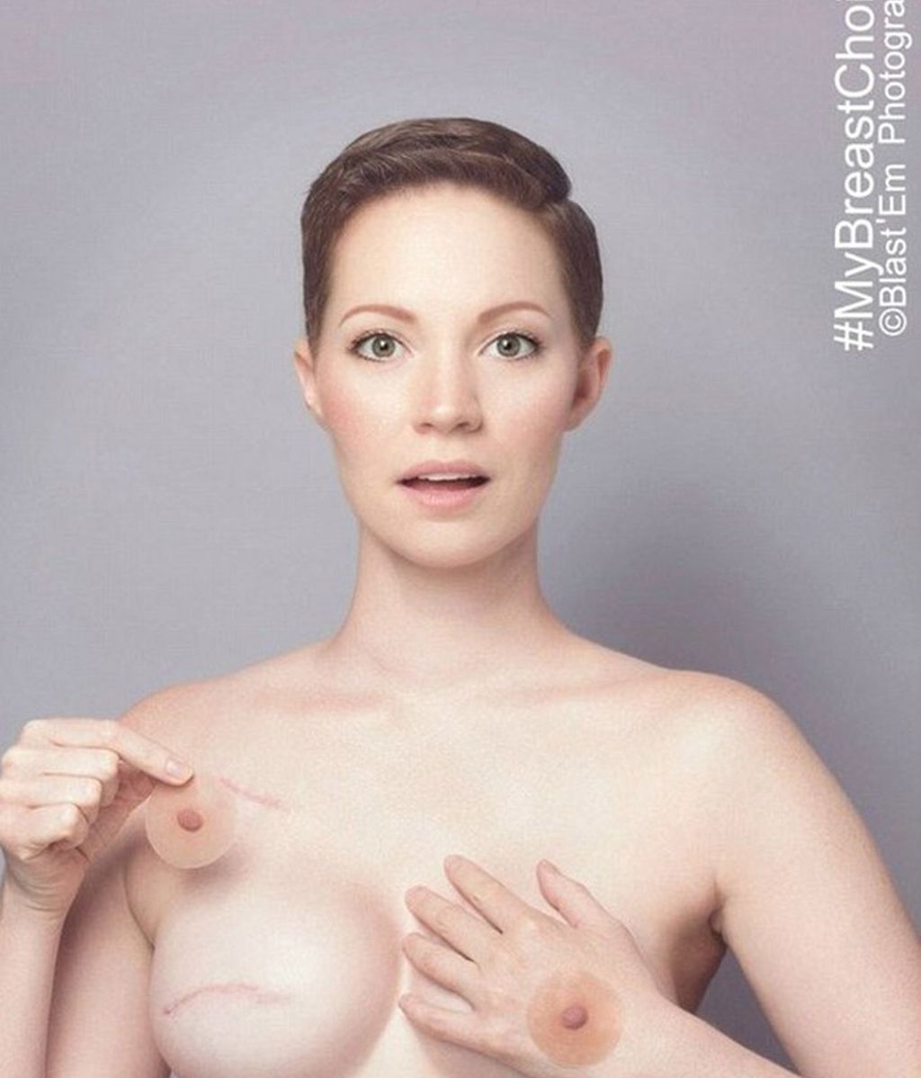 Cómo esta modelo superó el cáncer de mama usando el humor