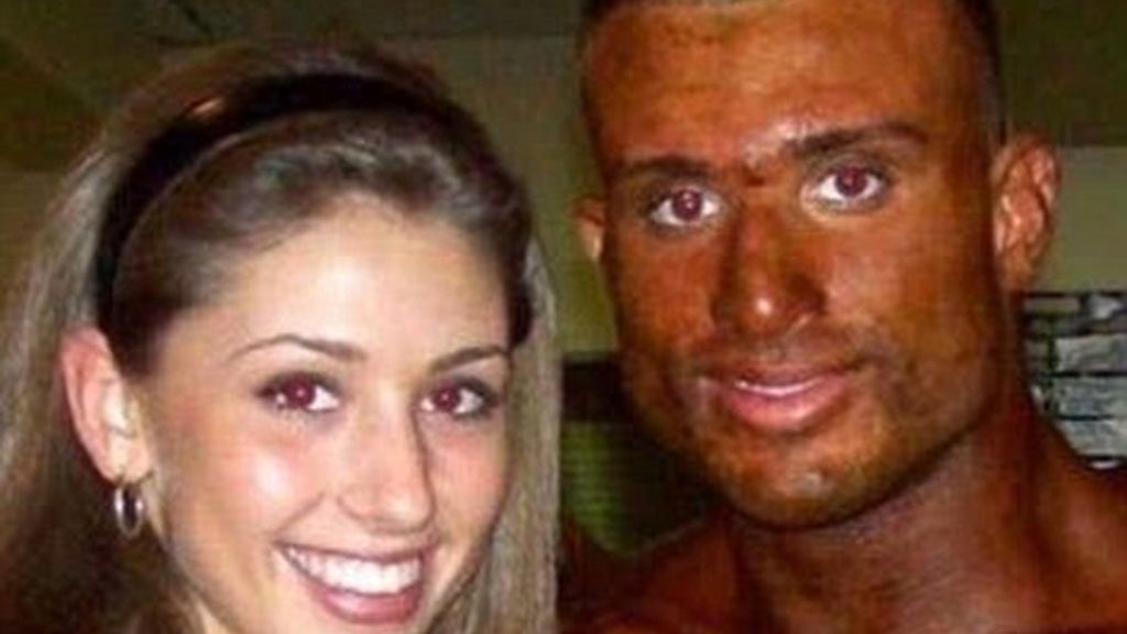 Los rayos UVA y el sol dañan la salud