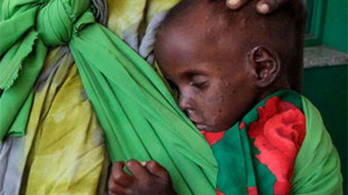 El Fondo de Naciones Unidas para la Infancia (UNICEF) ha advertido de que casi 720.000 niños podrían morir si no reciben ayuda urgente. FOTO: Gtres El Fondo de Naciones Unidas para la Infancia (UNICEF) ha advertido de que casi 720.000 niños podrían morir si no reciben ayuda urgente. FOTO: Gtres