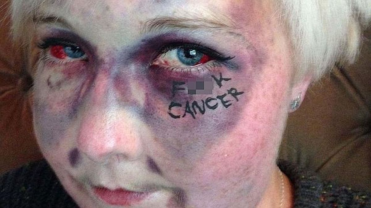 Impactante ‘selfie’ contra la leucemia