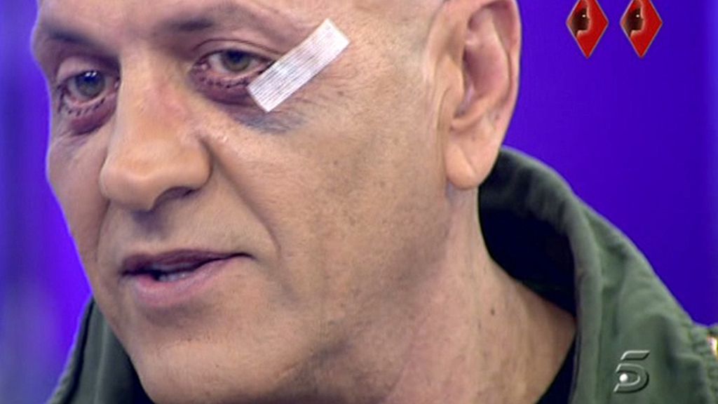Jorge Javier Vázquez le quita las gafas de sol a Kiko Matamoros