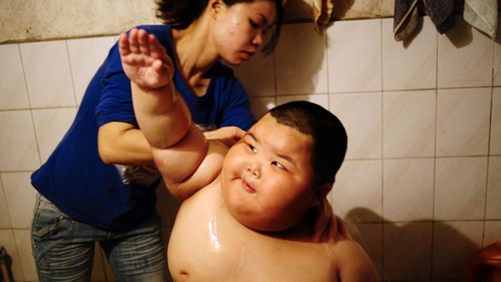 Con cuatro años y 62 kilos, es el niño más gordo del mundo