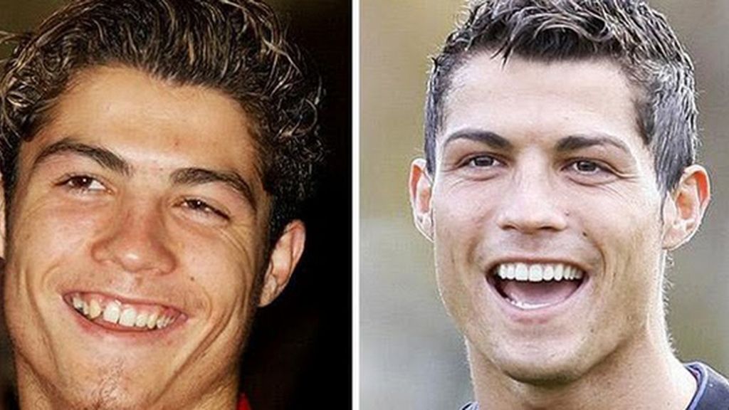 dientes