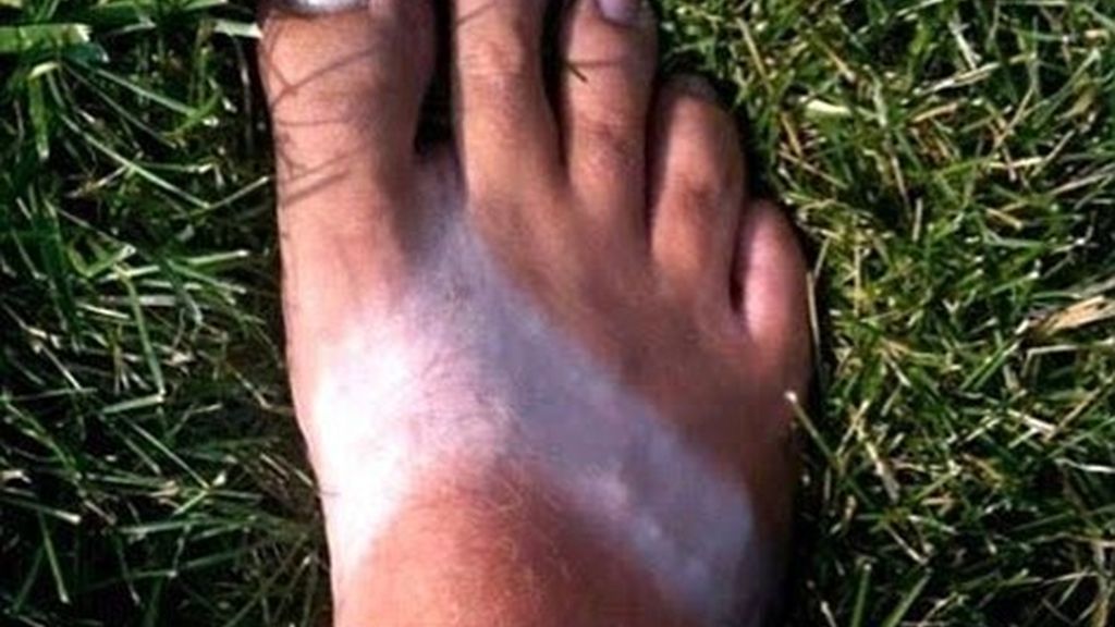 Los rayos UVA y el sol dañan la salud