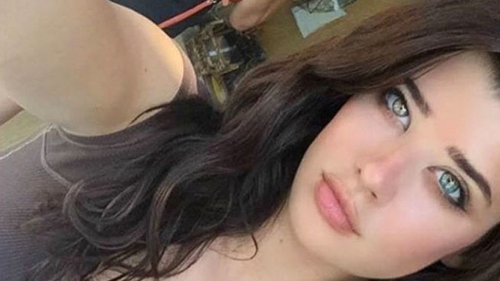 Nació con heterochromia iridum