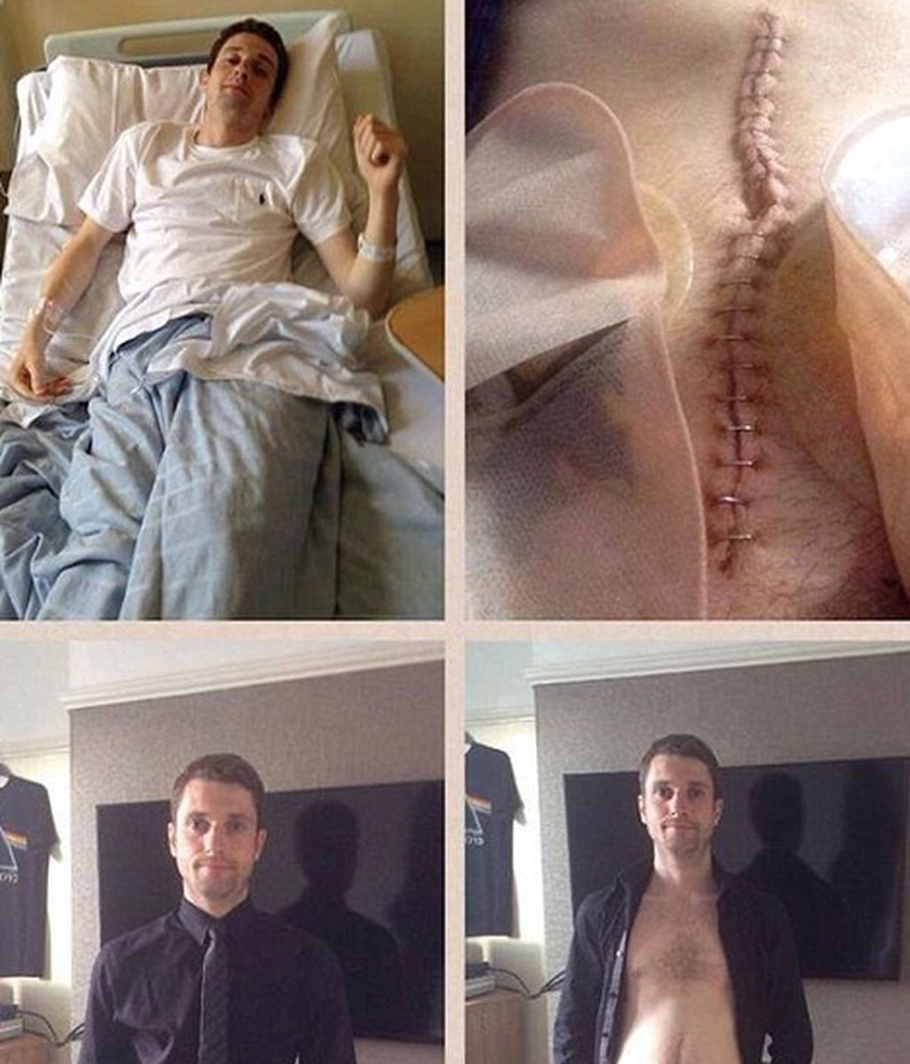 Cientos de enfermos de Crohn dejan de esconder sus fotos de resíduos gracias a la iniciativa de una modelo